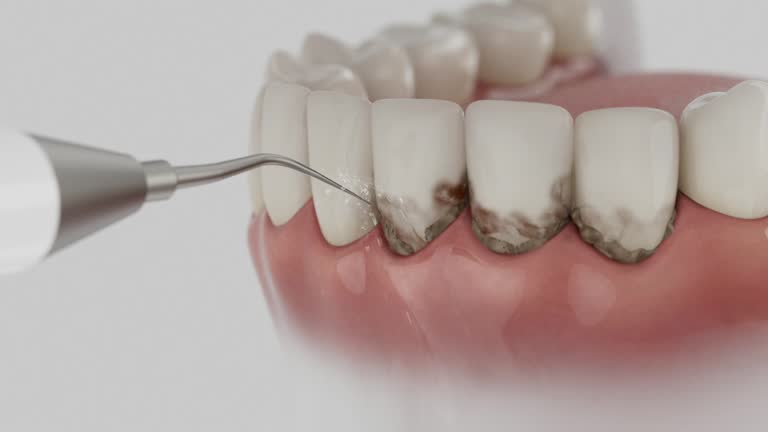 Reliable Dental Implants contractor in Doniphan, MO by Smile Center Dentistry